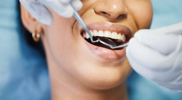 Best Emergency Wisdom Tooth Extraction in Hildale, UT